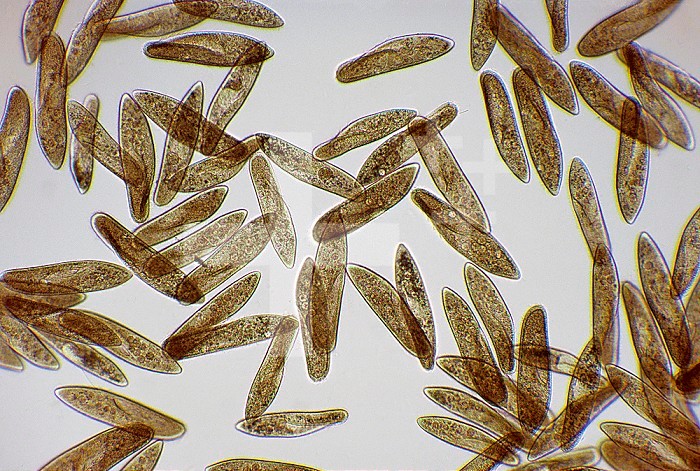 Paramecium caudatum culture. These so-called slipper animalcules are common freshwater Ciliate Protozoans. Brightfield LM X10.