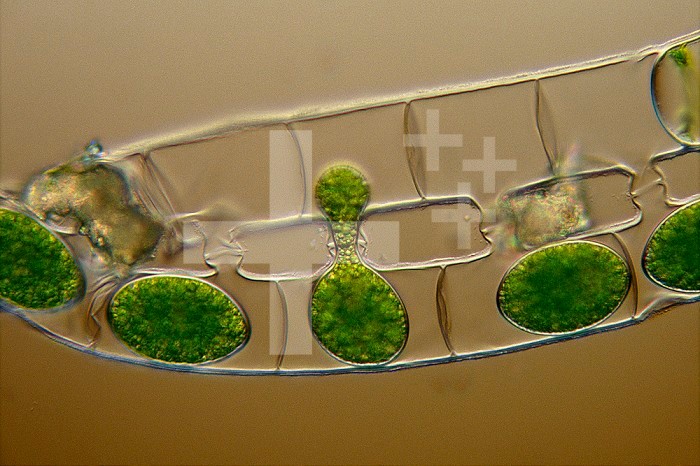 Conjugating Spirogyra, showing the connections between two strands of this filamentous Green Algae that often form masses of pond scum or flab in eutrophic waters. Conjugation is a sexual process whereby two cells fuse and exchange genetic information. DIC LM X10.