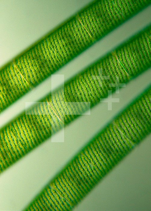 Spirogyra is a filamentous Green Algae that forms floating masses of pond scum or flab. The chloroplasts grow in a helix. DIC LM X10.