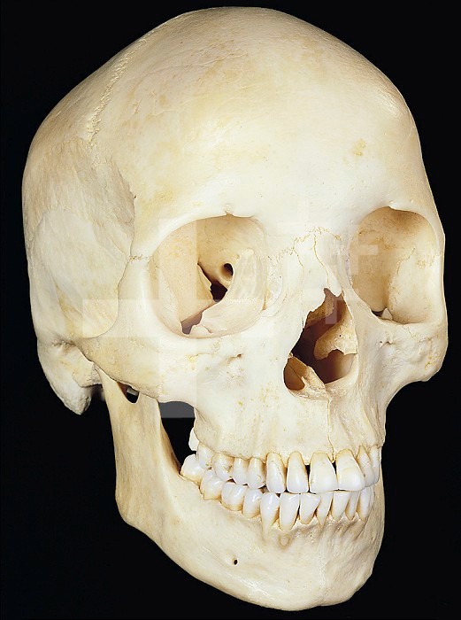 Human skull from front. Prominent features include the two eye sockets and the central opening of the nasal cavity (nose).