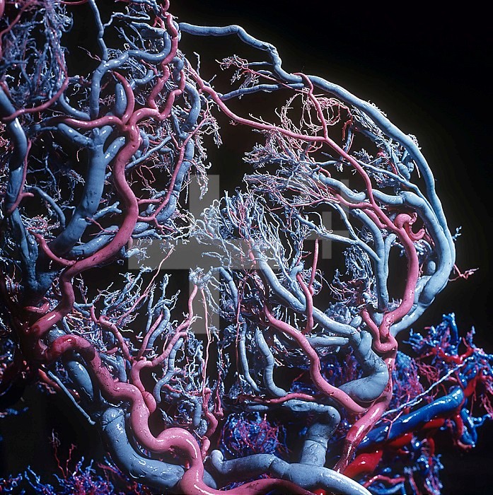 Resin cast of the human placental blood vessels which perfuse the placenta. Arteries are colored red and veins blue. Within the placenta, substances from the mother such as nutrients and oxygen pass to the fetus and waste exchange occurs. Triplets