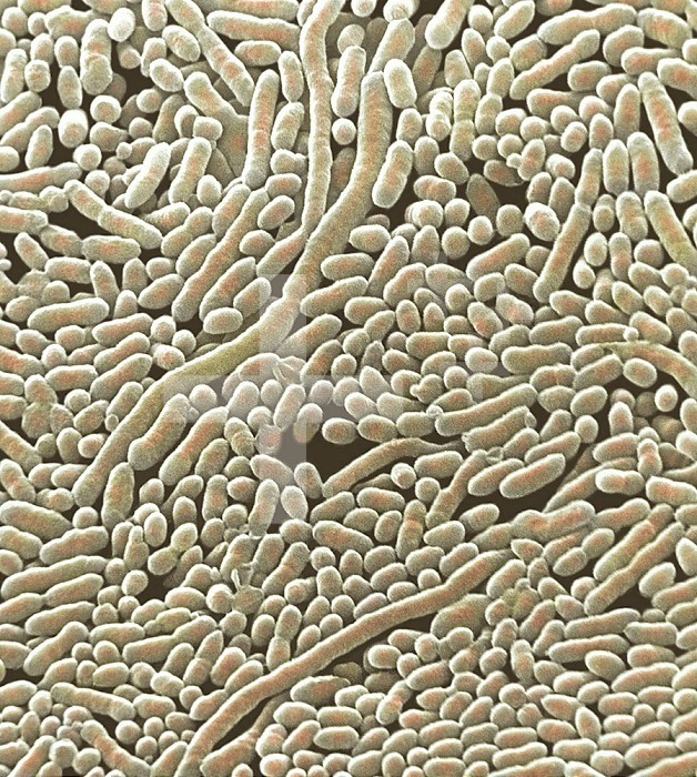 (Pseudomonas aeruginosa) Bacteria.   P. aeruginosa is an opportunistic pathogen. It rarely infects a healthy person and instead takes advantage of hospitalized patients with compromised immune systems. P. aeruginsosa is resistant to many antibiotics and responds poorly to others.  SEM X16,000
