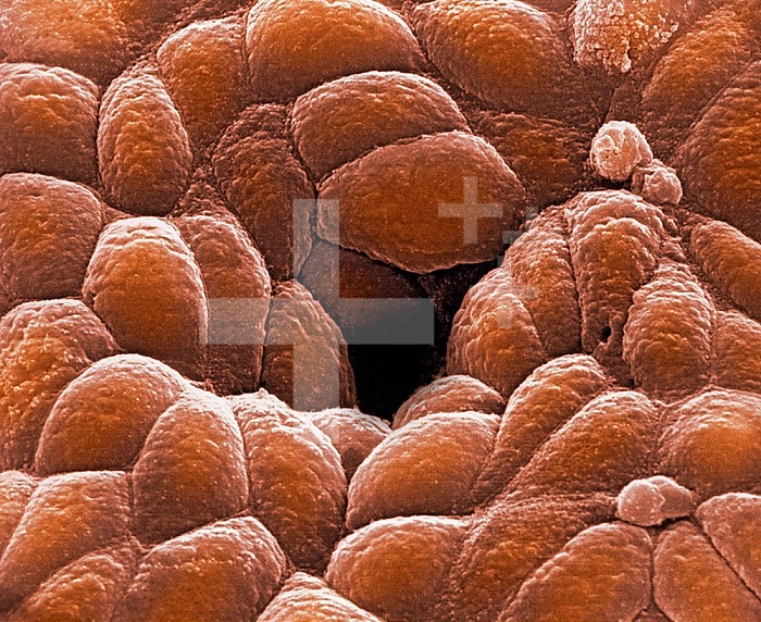 The opening of a gastric pit or gland viewed from the stomach lumen. SEM X5375.
