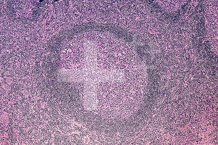 Normal human secondary lymphatic follicle with a germinal center, H&E stain. LM X26