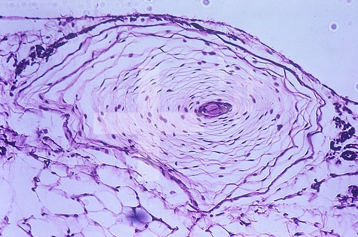 Cross section of the human pacinian corpuscle, a mechanoreceptor for pressure and touch. LM X35