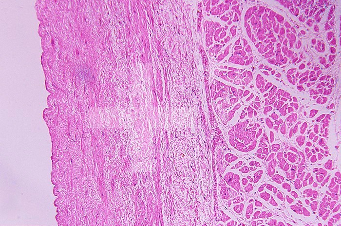 Cross section of human striated muscle from the left atrium. LM X30
