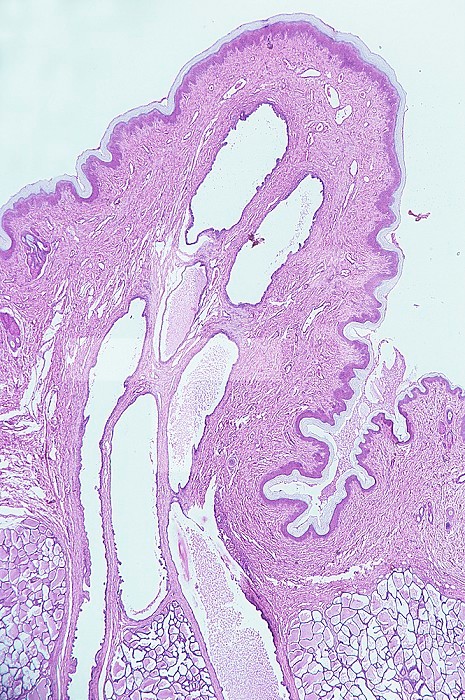 Longitudinal section of a nipple of a human breast showing the lactiferous ducts. LM X4