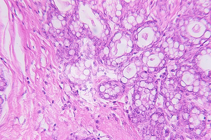 Cross section of normal human breast tissue. LM X80