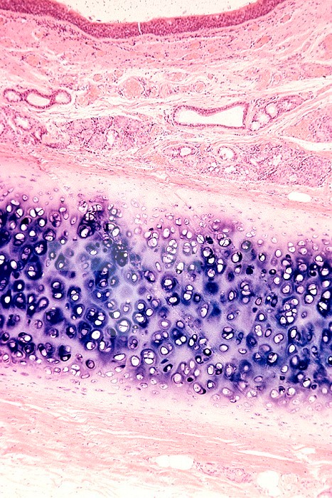 Hyaline cartilage in a cross-section of the trachea. LM X20.