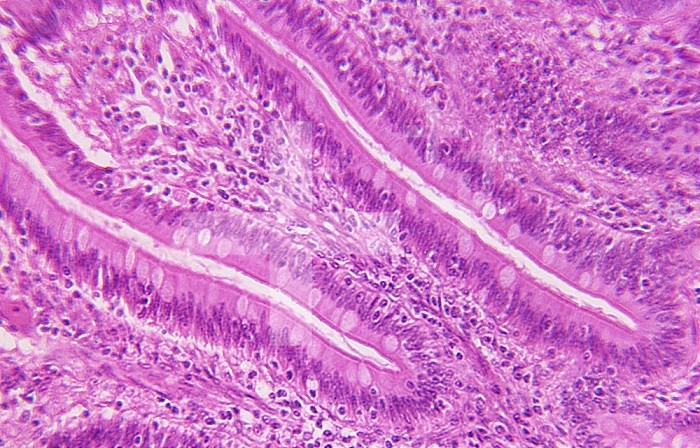 Cross section of simple columnar epithelium from the primate intestine. LM X80