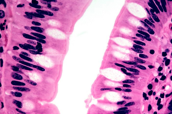 Simple columnar epithelium with goblet cells. LM X100