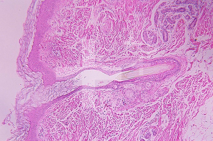 Sagittal section of a human fetal scalp skin with a hair shaft. LM X30