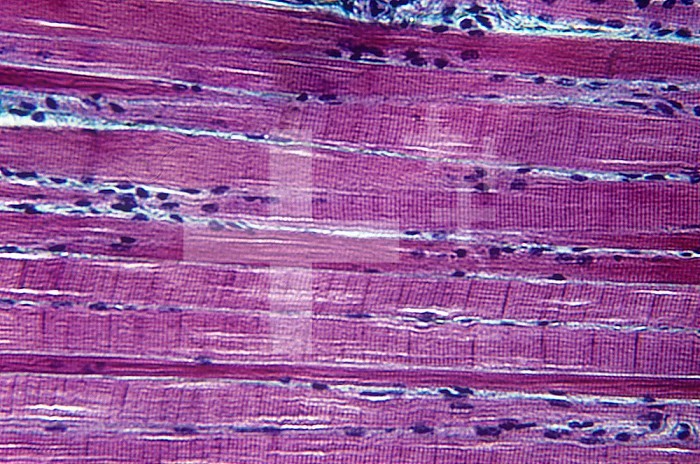 Human striated muscle, longitudinal section. LM X80