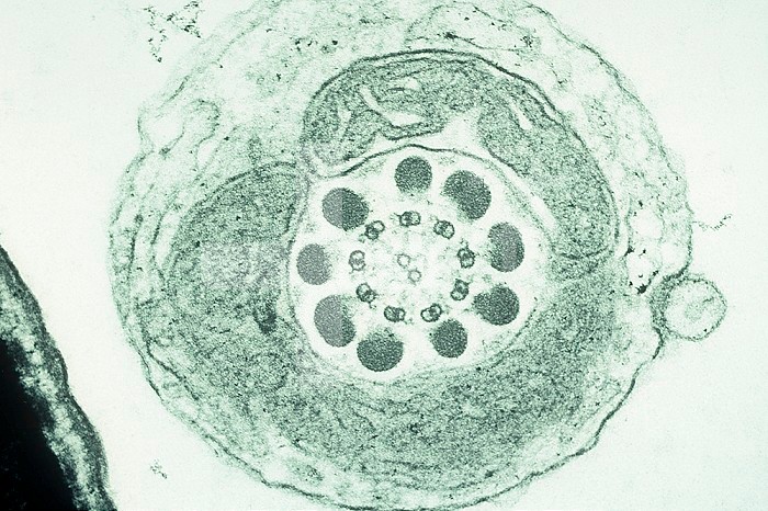 A cross-section of a human sperm tail or flagellum. TEM X175,000.