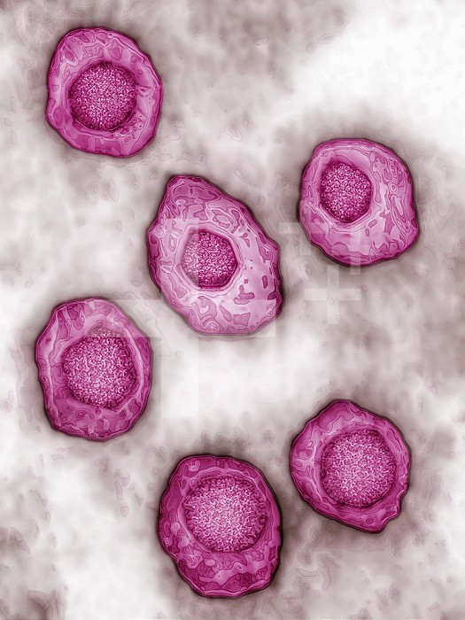 Epstein-Barr virus (human herpesvirus type 4, HHV-4). It causes infectious mononucleosis (glandular fever) and Burkitt´s lymphona. Image produced using high-dynamic-range imaging (HDRI) from an image taken with transmission electron microscopy. Viral diam