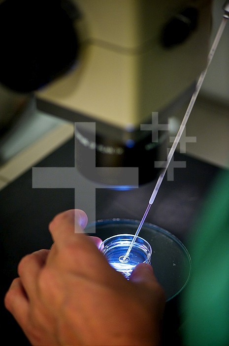 Reportage in the Medically Assisted Procreation (MAP) service in Antoine-Beclere hospital in France. IVF (In Vitro Fertilisation), embryo transfer. The embryos are placed in a thin plastic tube (catheter).