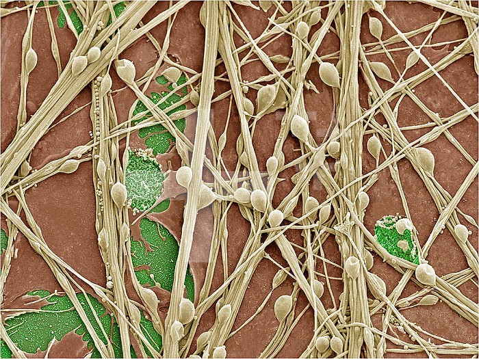 Cultured hippocampal neurons