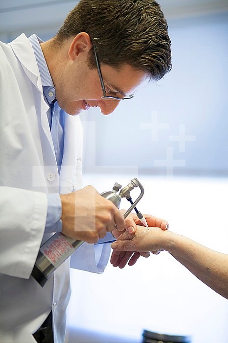 Reportage in a dermatology practice in Geneva, Switzerland. The dermatologist applies liquid nitrogen on liver spots to reduce them.