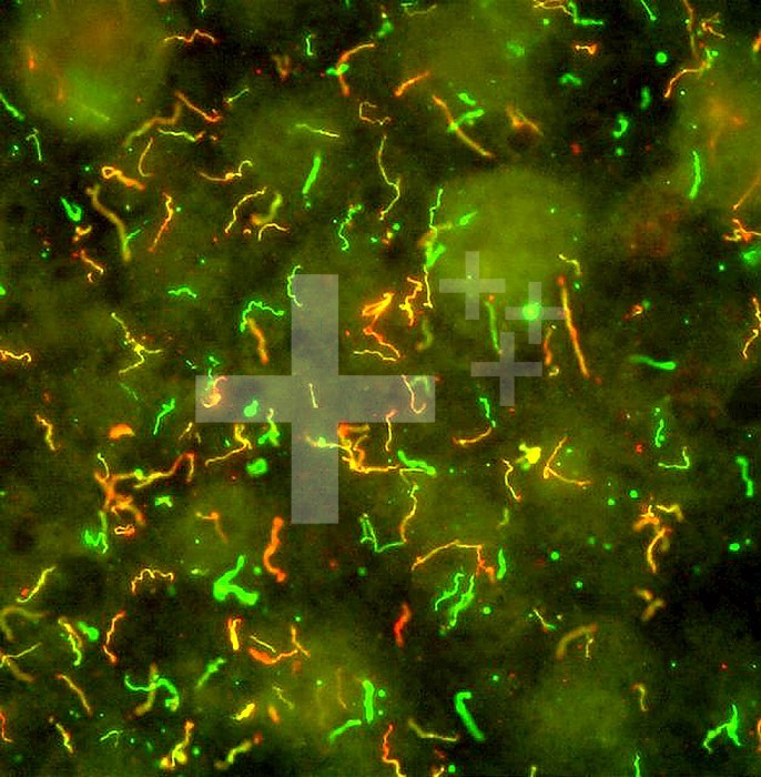 Lyme Disease Bacteria, Borrelia burgdorferi. The Lyme disease spirochete, Borrelia burgdorferi, is an obligate parasite that cycles between ticks and vertebrate hosts. B. burgdorferi alters the proteins expressed on its outer surface, depending on the state of each host. Here, we used immunofluorescent antibodies to identify spirochetes that express outer surface protein D (yellow and red) and merged the image with an image of all the spirochetes labeled with an anti-B. burgdorferi antibody (green).