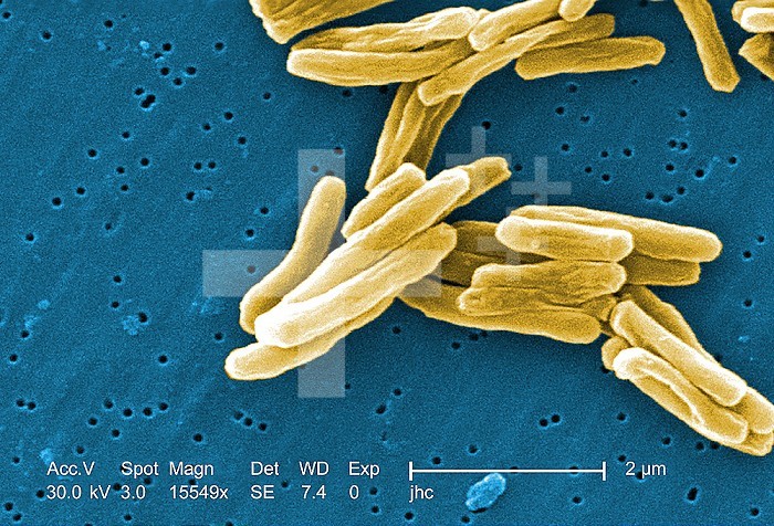 Under a high magnification of 15549x, this colorized scanning electron micrograph (SEM) depicted some of the ultrastructural details seen in the cell wall configuration of a number of Gram-positive Mycobacterium tuberculosis bacteria. As an obligate aerobic organism M. tuberculosis can only survive in an environment containing oxygen. This bacterium ranges in length between 2 - 4 microns, and a width between 0.2 - 0.5 microns.