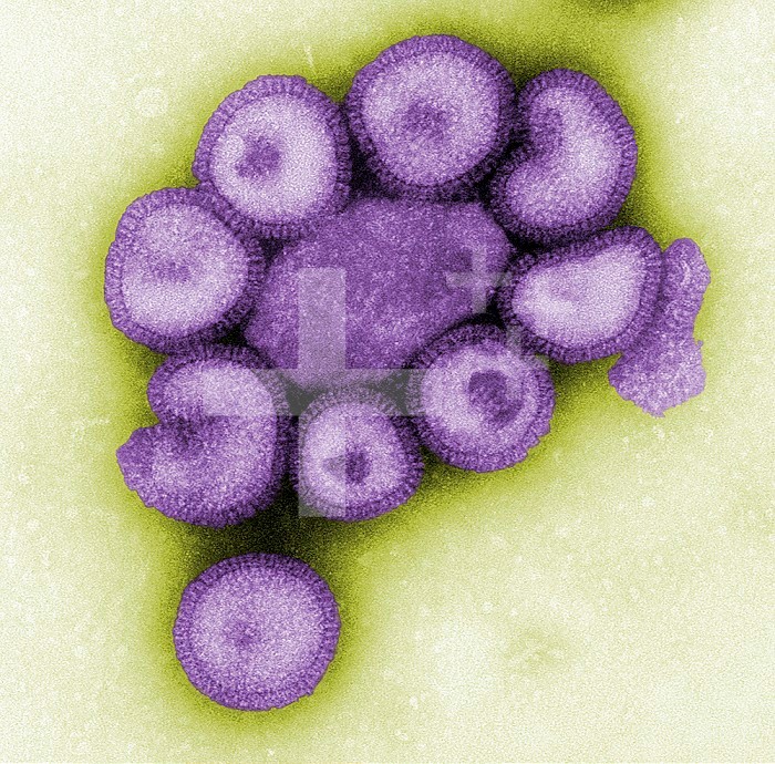 This colorized negative-stained transmission electron micrograph (TEM) depicts the ultrastructural details of a number of influenza virus particles, or virions. A member of the taxonomic family Orthomyxoviridae, the influenza virus is a single-stranded RNA organism. The flu is a contagious respiratory illness caused by influenza viruses. It can cause mild to severe illness, and at times can lead to death. The best way to prevent this illness is by getting a flu vaccination each fall.