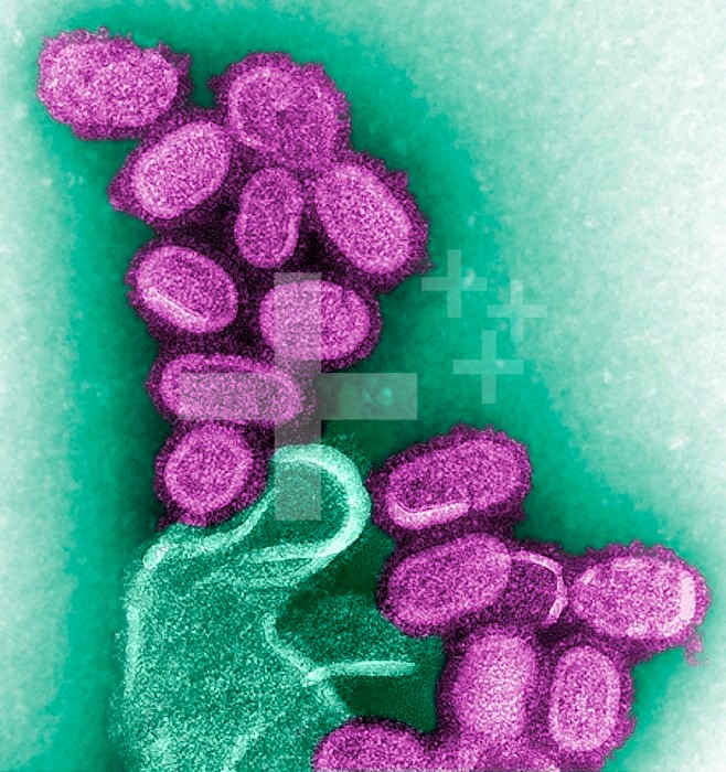 This colorized negative stained transmission electron micrograph (TEM) shows recreated 1918 influenza virions that were collected from supernatants of 1918-infected Madin-Darby Canine Kidney (MDCK) cells cultures 18 hours after infection. To separate these virions, the MDCK cells are spun down (centrifugation), and the 1918 virus in the fluid is immediately fixed for negative staining. The solid mass in lower center contains MDCK cell debris that did not spin down during the procedure.