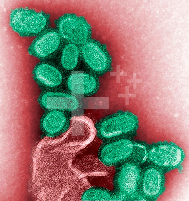 This colorized negative stained transmission electron micrograph (TEM) shows recreated 1918 influenza virions that were collected from supernatants of 1918-infected Madin-Darby Canine Kidney (MDCK) cells cultures 18 hours after infection. To separate these virions, the MDCK cells are spun down (centrifugation), and the 1918 virus in the fluid is immediately fixed for negative staining. The solid mass in lower center contains MDCK cell debris that did not spin down during the procedure.