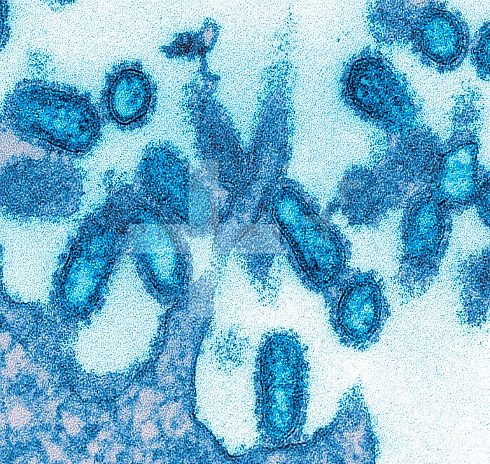 This colorized transmission electron micrograph (TEM) of an ultra-thin specimen revealed some of the ultrastructural morphologic features seen in 1918 influenza virus virions. The prominent surface projections on the virions are composed of either the hemagglutinin, or neuraminidase type of glycoproteins. Composed of what looked like dots or tubules, was a dense envelope known as a capsid, which surrounded each virions nucleic acid constituents.