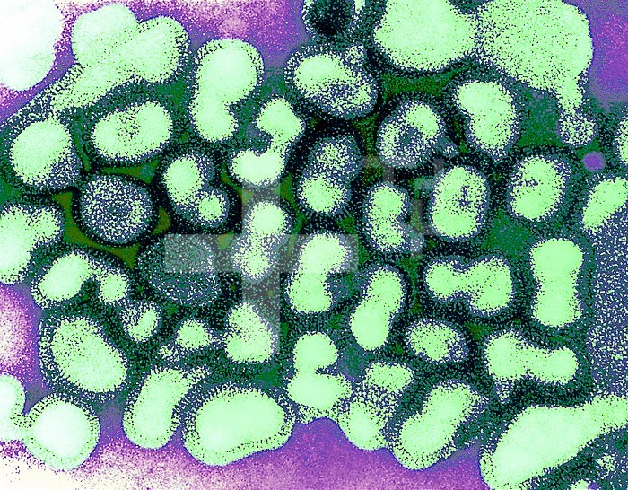 This colorized transmission electron micrograph (TEM) depicts numbers of influenza A virions while in their late passage growth phase.