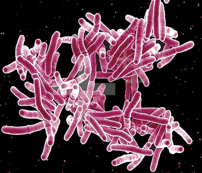 Scanning electron micrograph of Mycobacterium tuberculosis bacteria, which cause TB.