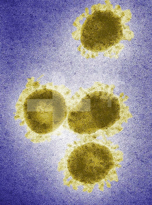 This digitally-colorized transmission electron micrograph (TEM) revealed the presence of a number of infectious bronchitis virus (IBV) virions, which are Coronaviridae family members, and members of the genus Coronavirus. IBV is a highly contagious pathogen, which infects poultry of all ages, affecting a number of organ systems including the respiratory and urogenital organs. IBV is categorized as a Group 3 coronavirus member, with a helical genome composed of positive-sense single-stranded RNA ((+) ssRNA). This is an enveloped virus, which means that its outermost covering is derived from the host cell membrane. The coronavirus derives its name from the fact that under electron microscopic examination, each virion is surrounded by a corona or halo. This is due to the presence of viral spike peplomers emanating from its proteinaceous capsid.
