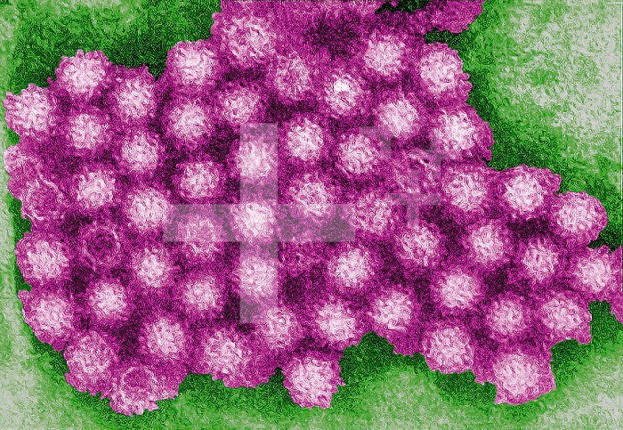 This transmission electron micrograph (TEM) revealed some of the ultrastructural morphology displayed by norovirus virions, or virus particles. Noroviruses belong to the genus Norovirus, and the family Caliciviridae. They are a group of related, single-stranded RNA, nonenveloped viruses that cause acute gastroenteritis in humans. Norovirus was recently approved as the official genus name for the group of viruses provisionally described as Norwalk-like viruses (NLV).