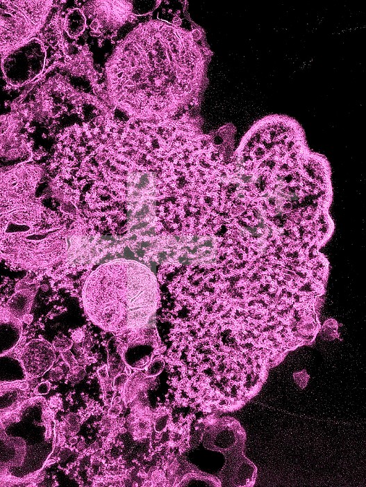 This transmission electron micrograph (TEM) depicted a number of Nipah virus virions that had been isolated from a patient´s cerebrospinal fluid (CSF) specimen. Nipah virus is a member of the family Paramyxoviridae, and is related, but not identical to He