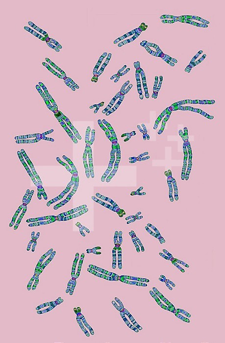 Human chromosomes. Illustration from transmission microscopy.