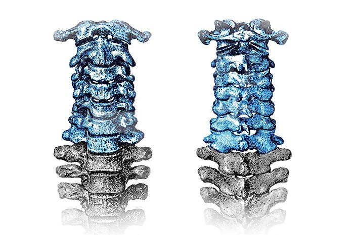 Frontal and rear view illustration of the cervical vertebra.