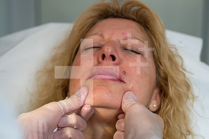 Reportage in the Mozart Clinic in Nice, France. After injecting hyaluronic acid, the surgeon presses down on the patient’s face to make the acid penetrate and to spread it correctly under the skin.