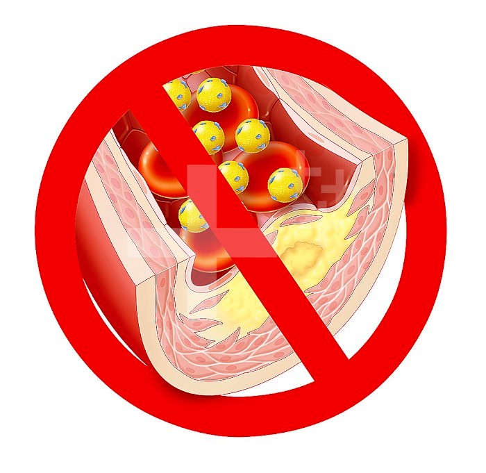 Pictogram warning against cholesterol.