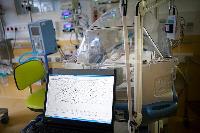 Reportage in a mobile functional exploration unit. A nurse intervenes in a neonatal service to carry out a check-up EEG on some premature babies. The EEG enables the development of the brain to be monitored. An extremely preterm baby, born at 25 weeks of 