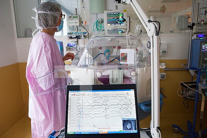 Reportage in a mobile functional exploration unit. A nurse intervenes in a neonatal service to carry out a check-up EEG on some premature babies. The EEG enables the development of the brain to be monitored. An extremely preterm baby, born at 25 weeks of 