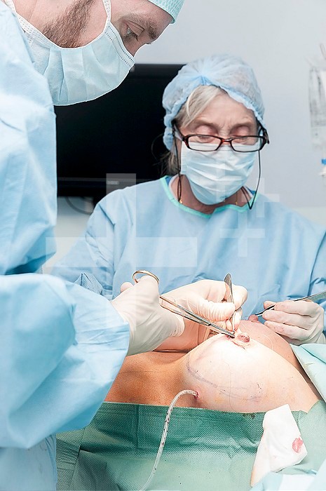 Reportage in the Mozart plastic surgery clinic in Nice, France. Fitting breast implants using the round block technique. Stitching both sides simultaneously.