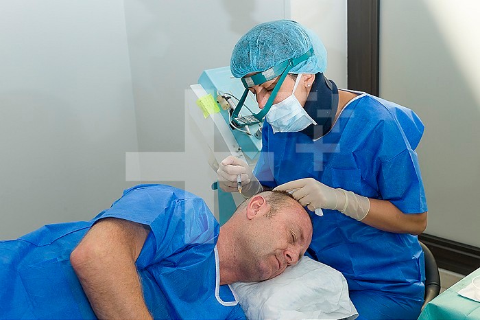 Reportage in the Mozart plastic surgery clinic in Nice, France. FUE (Follicular Unit Extraction) hair transplant on a patient who has already undergone two strip harvesting sessions which have left scars. FUE will avoid this. FUE involves harvesting individual follicular units using a hollow needle that is 0.9-1.2mm in diameter, and reimplanting them in the bald patch. Local anesthetic.