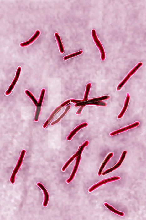 Koch’s bacillus (or Mycobacterium tuberculosis), the bacteria responsible for tuberculosis. Seen under optical microscopy X 1000.