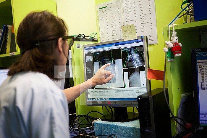 Reportage in the radiotherapy unit of a hospital in Savoie, France. Two technicians monitor the radiotherapy session. Treatment for cervical and dorsal adenocarcinoma.