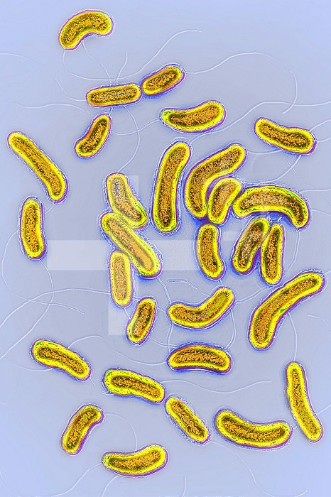 Vibrio cholerae bacterium responsible for cholera. Image produced using optical microscopy X 2000.